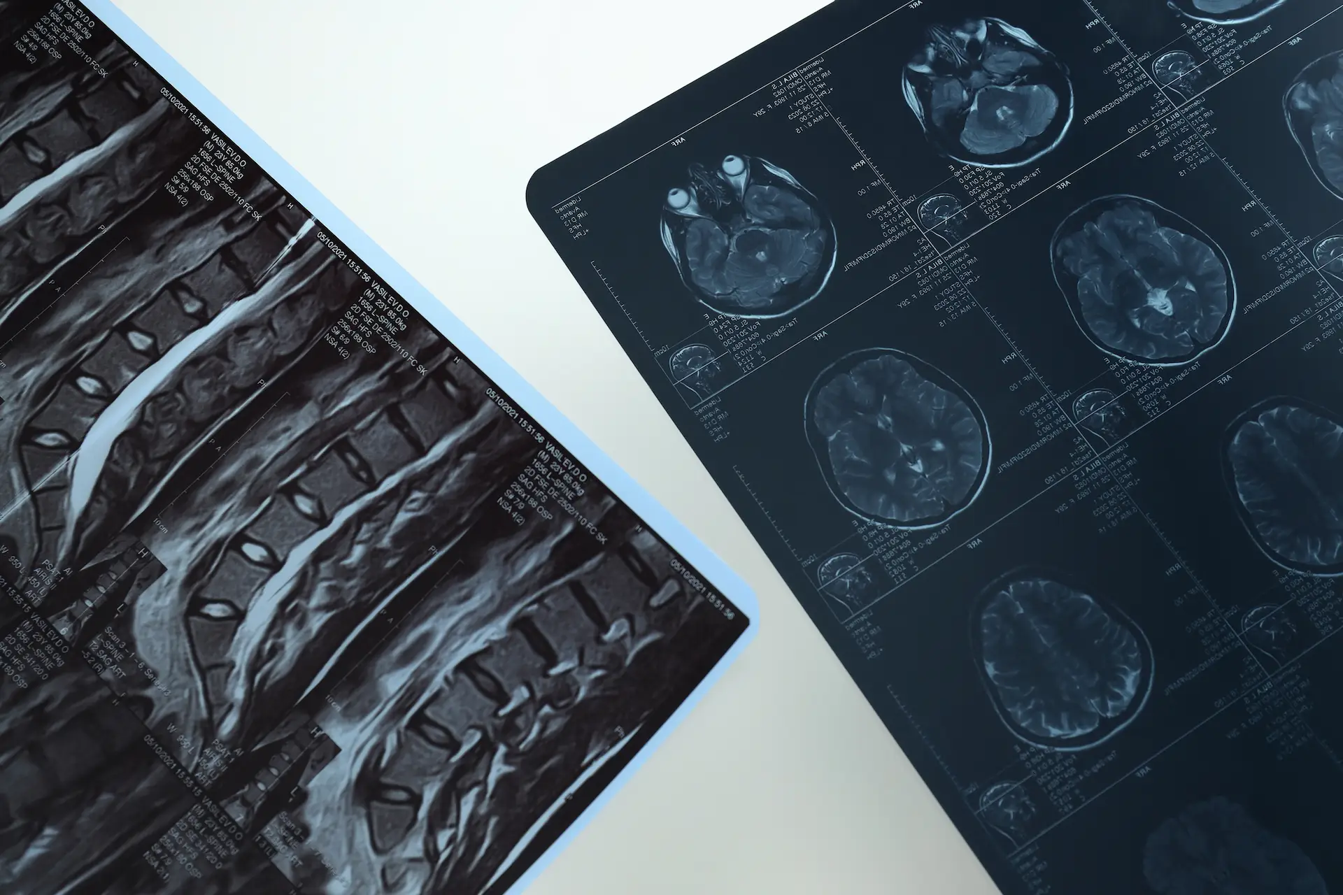 diagnostica per immagini lastre radiologia